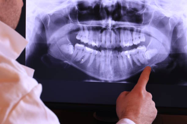 Best Walk-In Emergency Dentist in Kennedale, TX