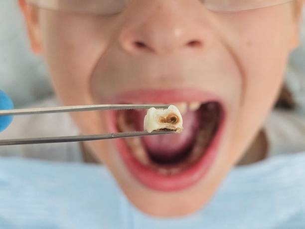 Best Emergency Dental Care for Trauma or Injury in Kennedale, TX